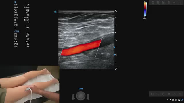 Maîtrisez l’Écho-Doppler Vasculaire – 35 h de Formation Vidéo HD (Théorie + Pratique + Cas Réels)